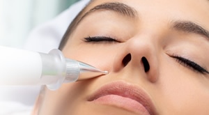 Neugodne bradavice, fibrome i keratoze UKLONITE bezbolno uz PLASMA PEN u Beauty centru Kozlinger u Zagrebu - uklanjanje 1 ili do 10 izraslina!