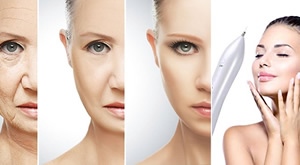 Tajna ZATEGNUTE kože bez bora je otkrivena! Napredni i NEKIRURŠKI LIFTING lica - PLASMA PEN u Beauty Centru Kozlinger u Zagrebu uz 4 opcije izbora regije tretmana!