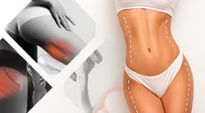 TESLA EMS + RF U ZAGREBU! Bio+klinik uništava CELULIT i zateže kožu za samo 19 €. Brzi tretman od 30 min za SAVRŠENO TIJELO. Iskoristite AKCIJU i ulovite svoj termin odmah!