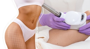 [NEINVAZIVNA LIPOSUKCIJA] Melanis - Studio za njegu lica i tijela Zagreb donosi 6x MedContour cijelog trbuha ili bedara! Odaberite zonu, riješite se celulita i masnih naslaga uz VRHUNSKU TEHNOLOGIJU!