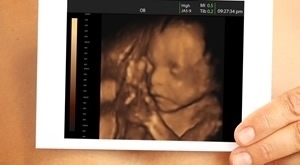 4D ultrazvuk bebe s DVD snimkom i anomaly scan u Zagrebu - Poliklinika dr. Đurića nudi dinamičan 3D prikaz i detaljan pregled razvoja fetusa uz video uspomenu za trudnice!