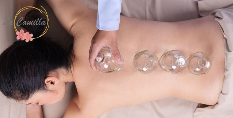 La Cammila Beauty Bar - medicinska masaža leđa i cupping terapija