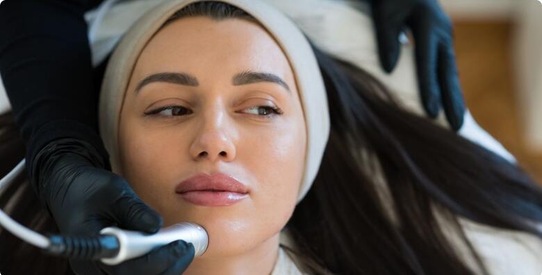HydraFacial tretman koji uklanja nečistoću i masnoće u Studiju ljepote Manuela