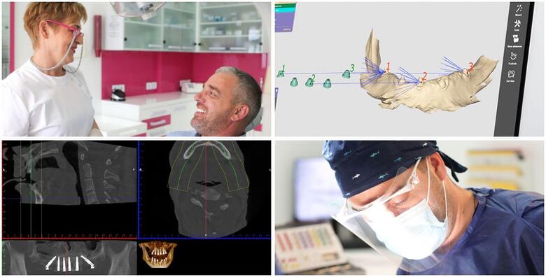 CBCT 3D snimka kompletne gornje i donje čeljusti uz detaljnu analizu snimke, besplatan dentalni pregled i konzultacije