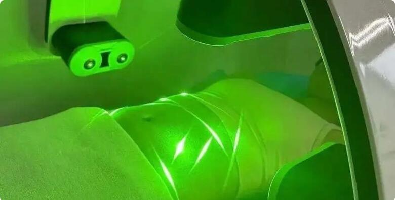 REVOLUCIJA MRŠAVLJENJA - 4 tretmana Green Cold Laserom i GRATIS 2 limfne drenaže