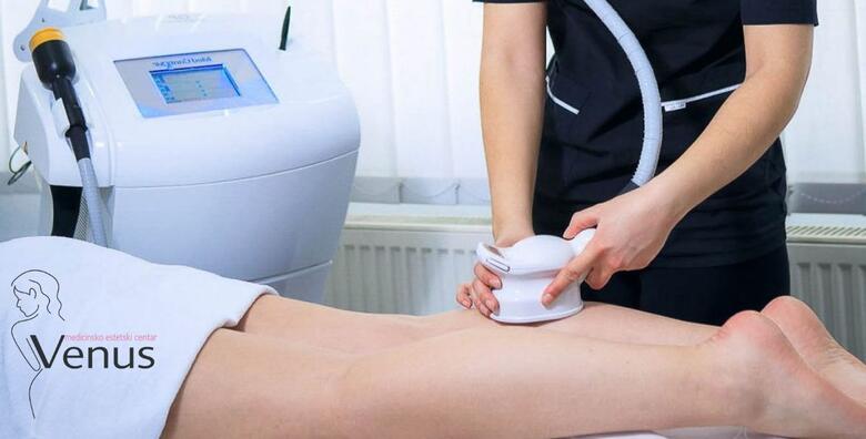 MED2CONTOUR u Medicinsko estetskom centru Venus, SESVETE