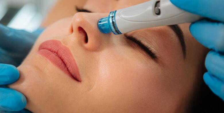 Tretman lica Hydrafacial Platinum (11 u 1) + anti-age lifting masaža lica gratis- tretman za vrhunsku njegu, anti-age učinak, lifting i regeneraciju u salonu Medical Sculpture