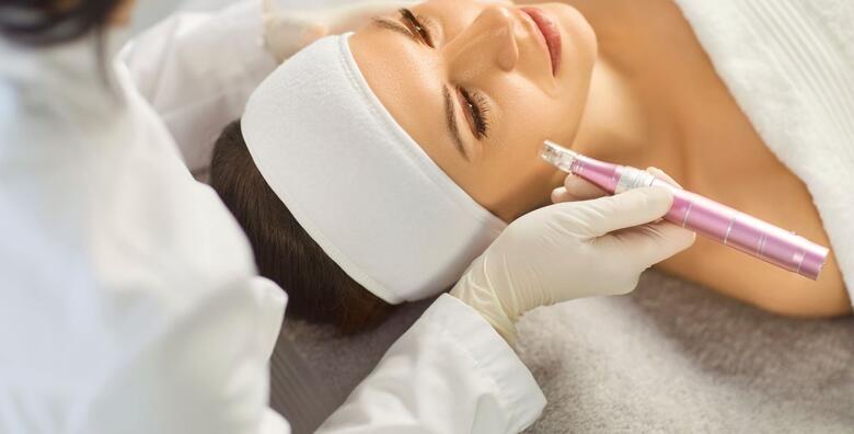 Derma roler + Derma pen u Beauty salonu LaVi